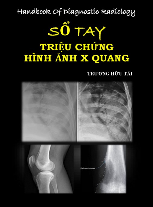 Sổ tay Triệu chứng hình ảnh X quang