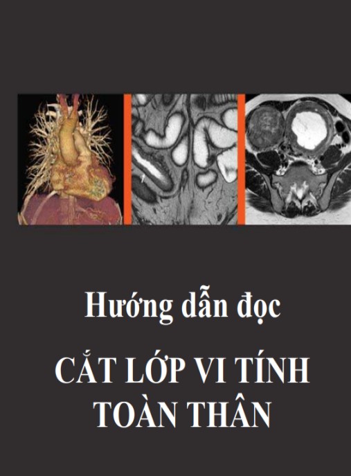 Hướng Dẫn Đọc Cắt Lớp Vi Tính Toàn Thân